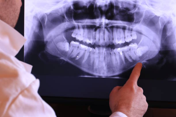 Best Cosmetic Emergency Dentistry in West Burlington, IA