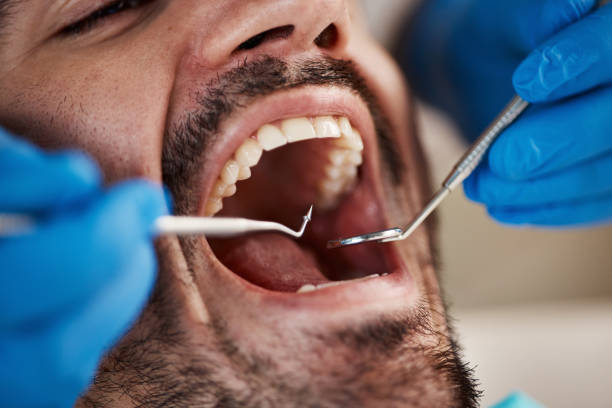 Best Urgent Care for Lost Fillings or Crowns in West Burlington, IA